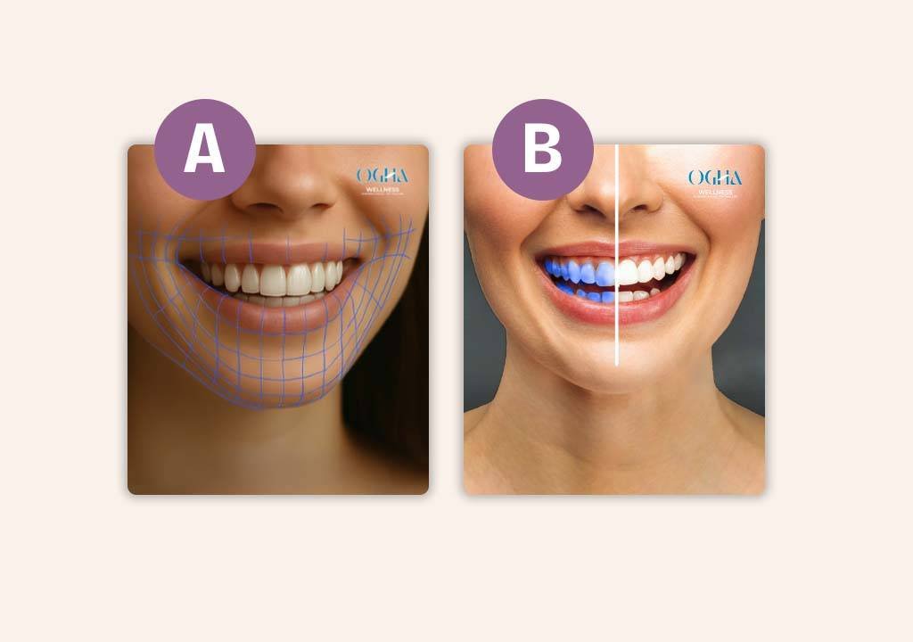 Performance Marketing